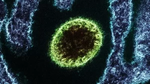 Virus Nipah. magazinealdia.com